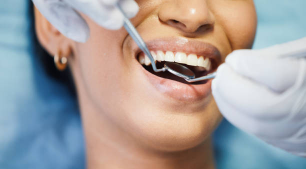 Best Emergency Dentist for Knocked-Out Tooth in Gold Hill, OR