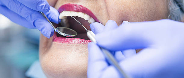 Best Broken or Cracked Tooth Emergency Dentist in Gold Hill, OR