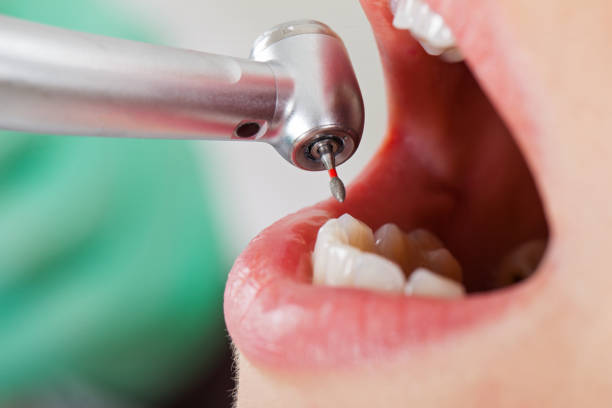 Best Emergency Dental Services for Seniors in Gold Hill, OR